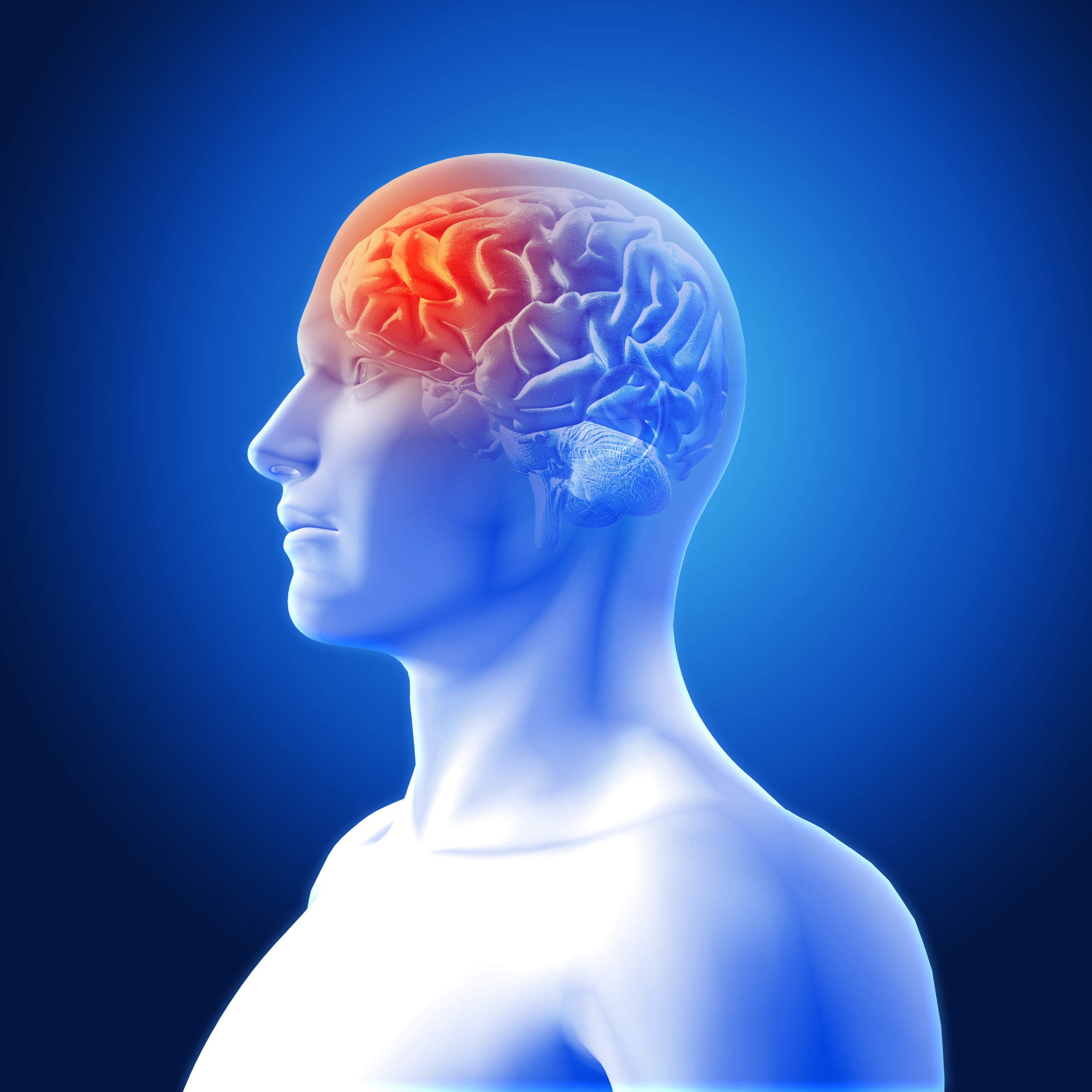 3D render of a medical image showing brain in male figure with frontal lobe highlighted